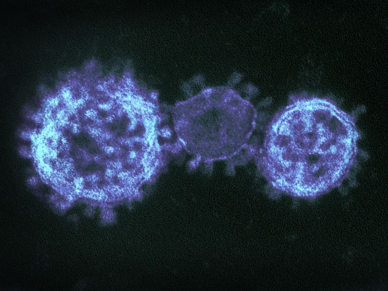 Mikroskopische Darstellung von leuchtend blauen Zellstrukturen auf dunklem Grund, die eine fehlerhafte Immunreaktion bei unerkannten Nahrungsmittelunverträglichkeiten auf zellulärer Ebene visualisiert.